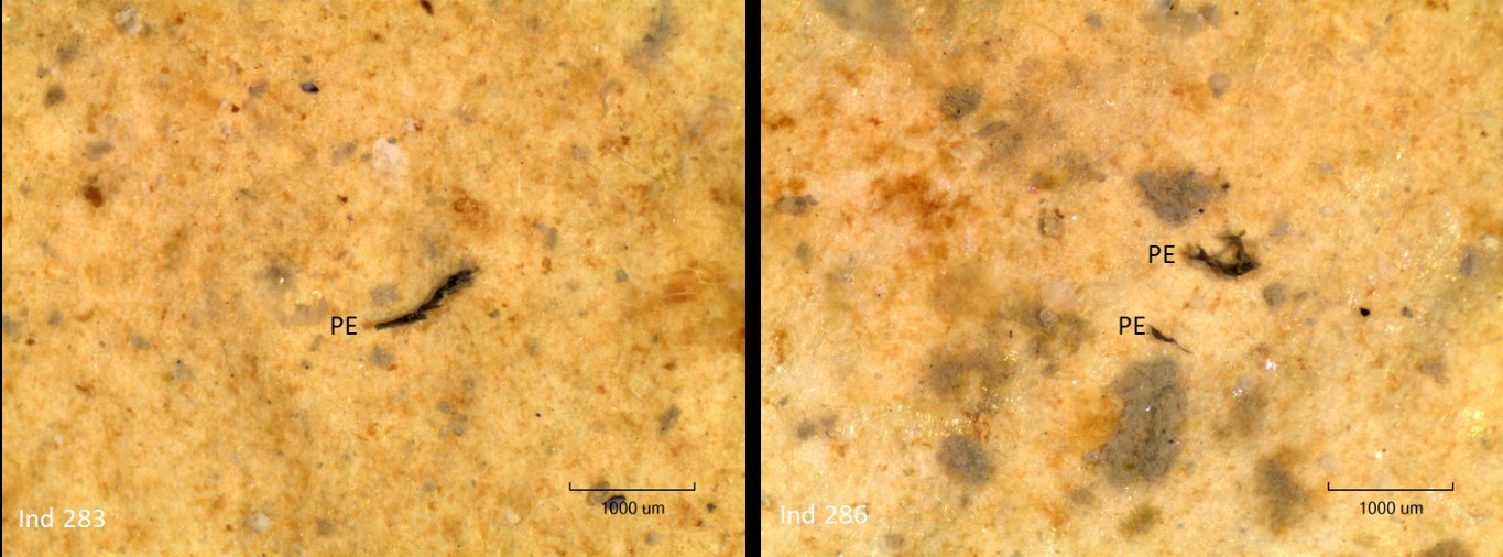 Microscope images, with PE marked